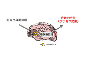 病は気から」は本当か？ アレルギー界の大きな謎に挑む